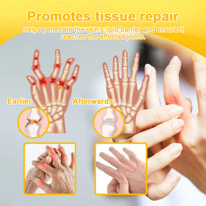 XRLXRL® Bee Venom Pain-Relief Bone Healing Cream 👨‍⚕️(Specially for older adults)