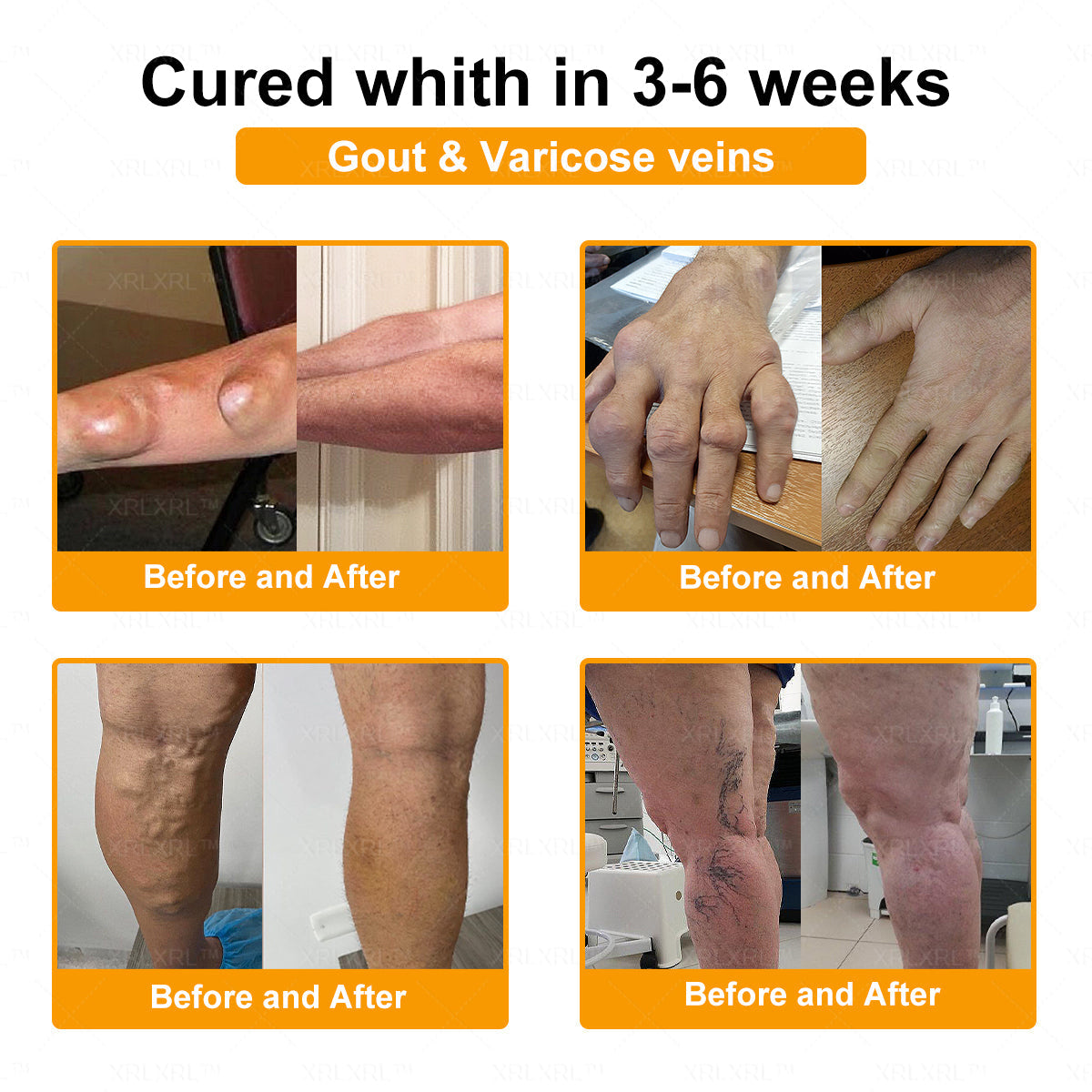 XRLXRL® Bee Venom Pain-Relief Bone Healing Cream 👨‍⚕️(Specially for older adults)