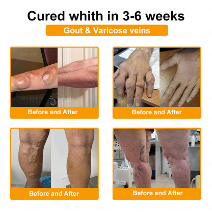 XRLXRL® Bee Venom Pain-Relief Bone Healing Cream 👨‍⚕️(Specially for older adults)