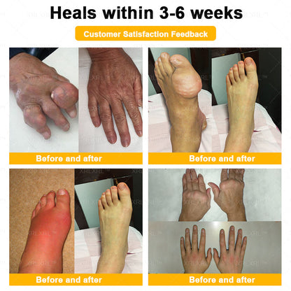 XRLXRL® Bee Venom Pain-Relief Bone Healing Cream 👨‍⚕️(Specially for older adults)