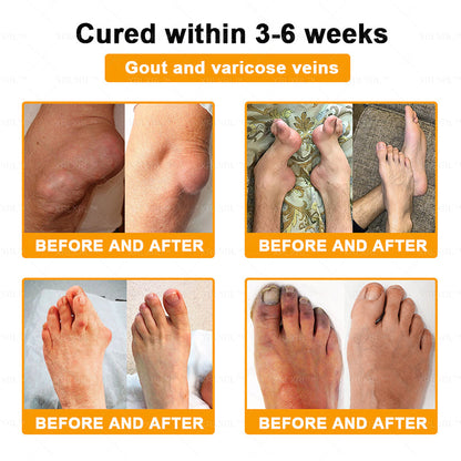 XRLXRL® Bee Venom Pain-Relief Bone Healing Cream 👨‍⚕️(Specially for older adults)
