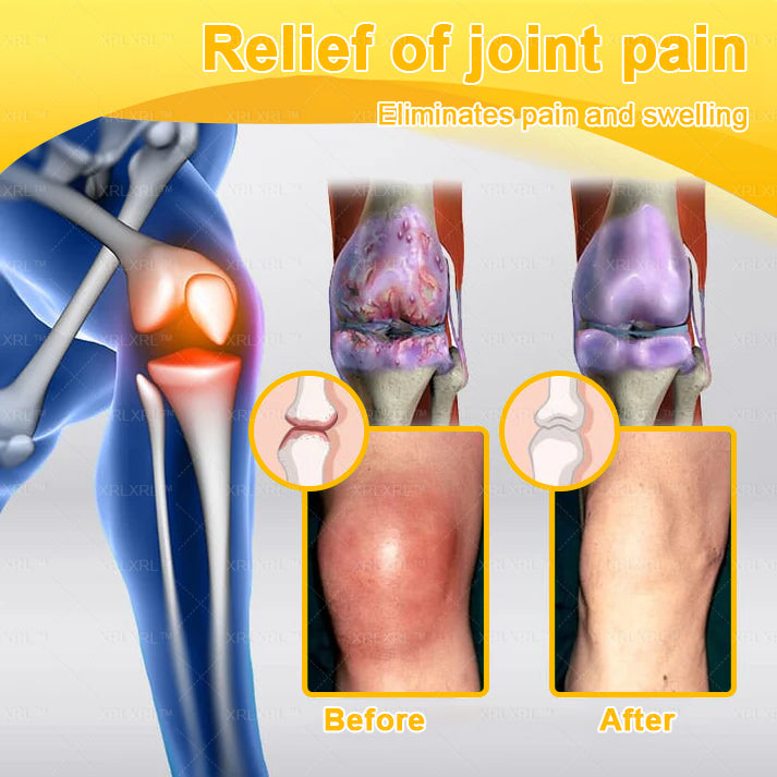 XRLXRL® Bee Venom Pain-Relief Bone Healing Cream 👨‍⚕️(Specially for older adults)